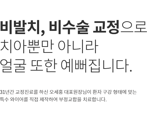 안면비대칭 비발치, 비수술 교정으로  치아뿐만 아니라  얼굴 또한 예뻐집니다.